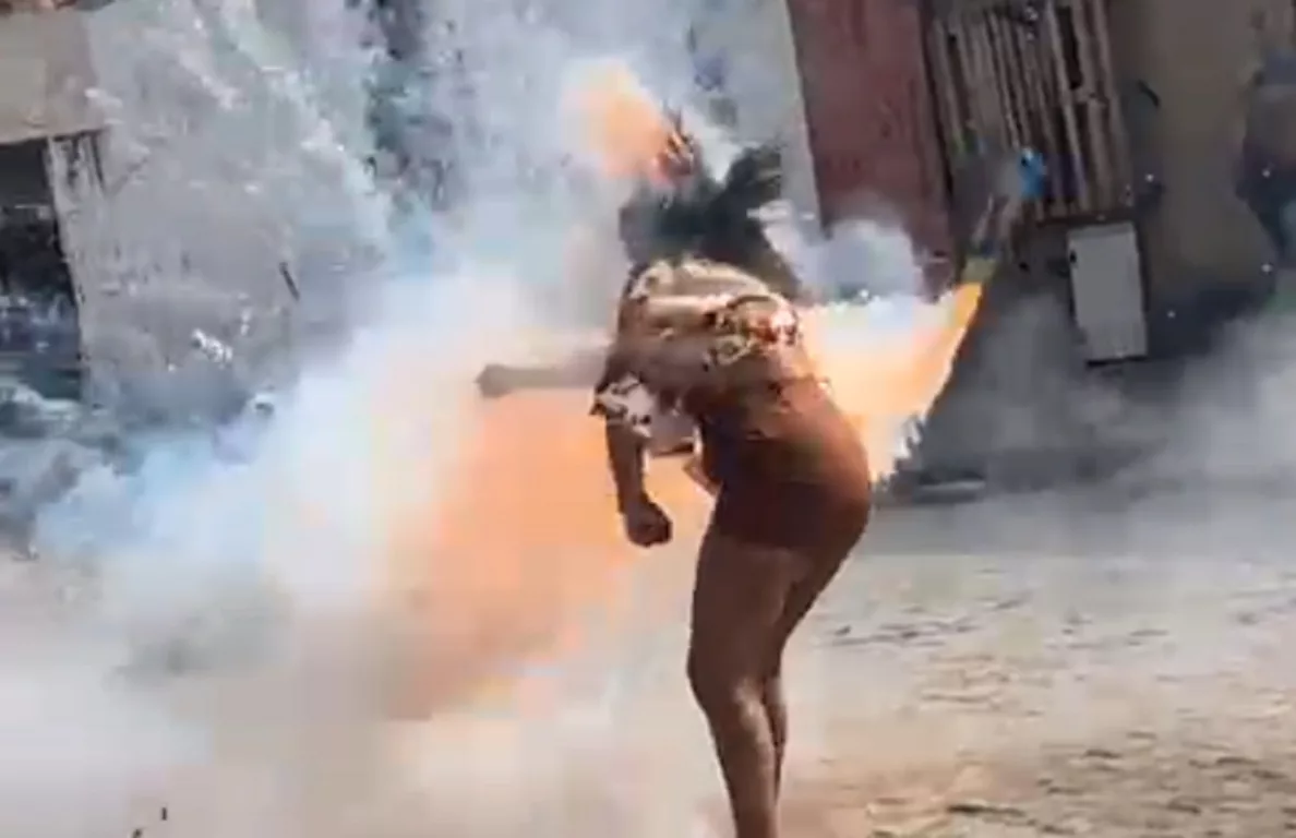 Imagem de Mulher é atingida no rosto por espada junina em Cruz das Almas