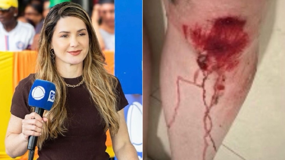 Imagem de Repórter da Record fica ferida após reagir a assalto na porta de casa em Salvador