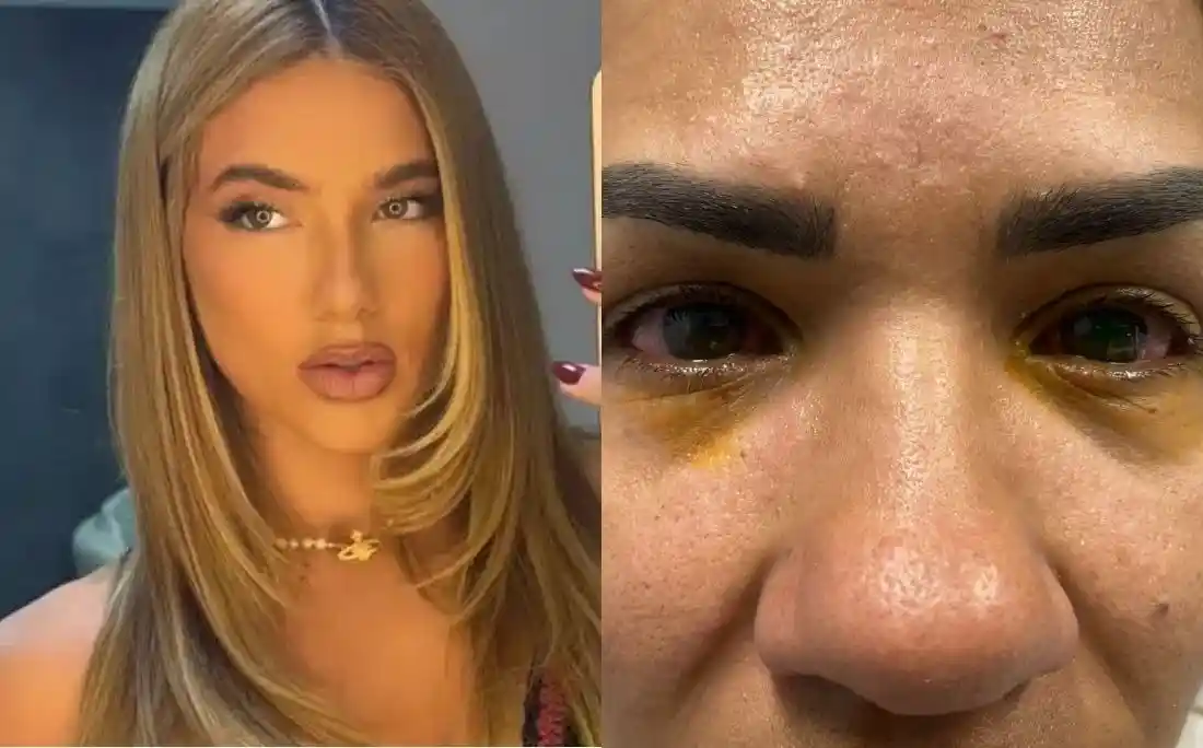 Imagem de Mulher relata cegueira temporária após usar produto da marca de Virginia Fonseca