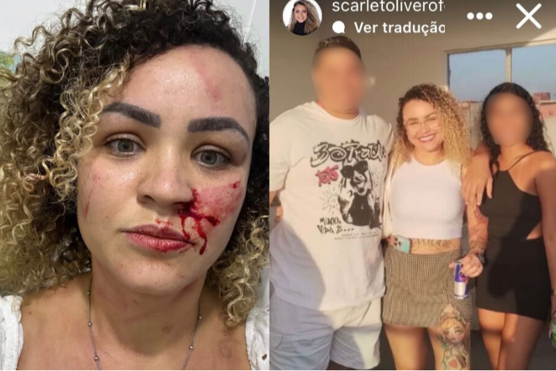 Imagem de Blogueira denuncia agressão de ex-companheiro e amiga pelas redes sociais
