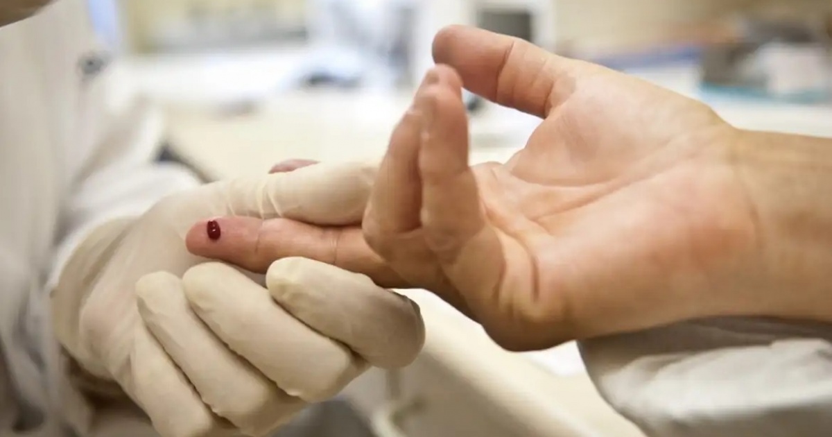 Imagem de Sesab nega surto de HIV na Bahia